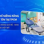 Top địa chỉ niềng răng giá rẻ, chất lượng tại TPHCM