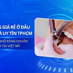Nhổ răng giá rẻ ở đâu uy tín? các điều bạn cần biết
