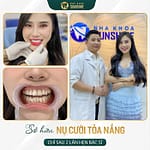 Khám Phá Công Nghệ Răng Sứ Venus Plus Tốt Nhất 2024